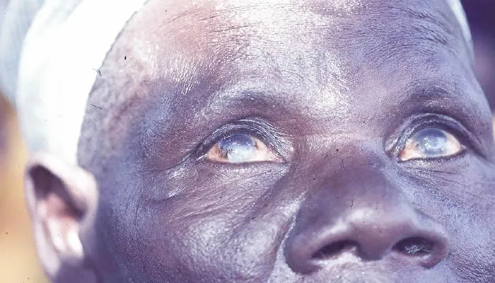 Advocates Demand Safer Roads for Visually Impaired Nigerians