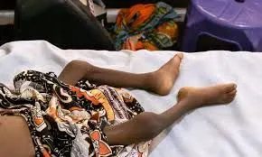 MSF Warns of Rising Malnutrition and Disease in Nigeria