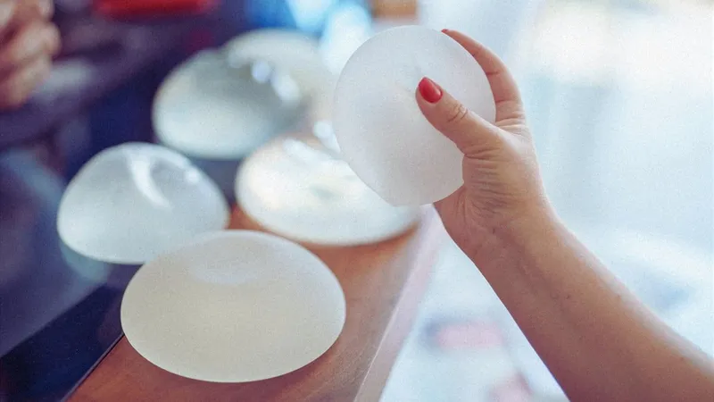 Surge in Used Breast Implant Sales Amid Russia's Crisis